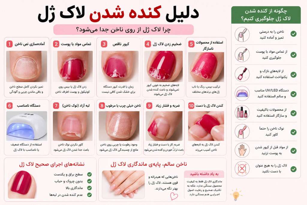 دلیل کنده شدن لاک ژل
